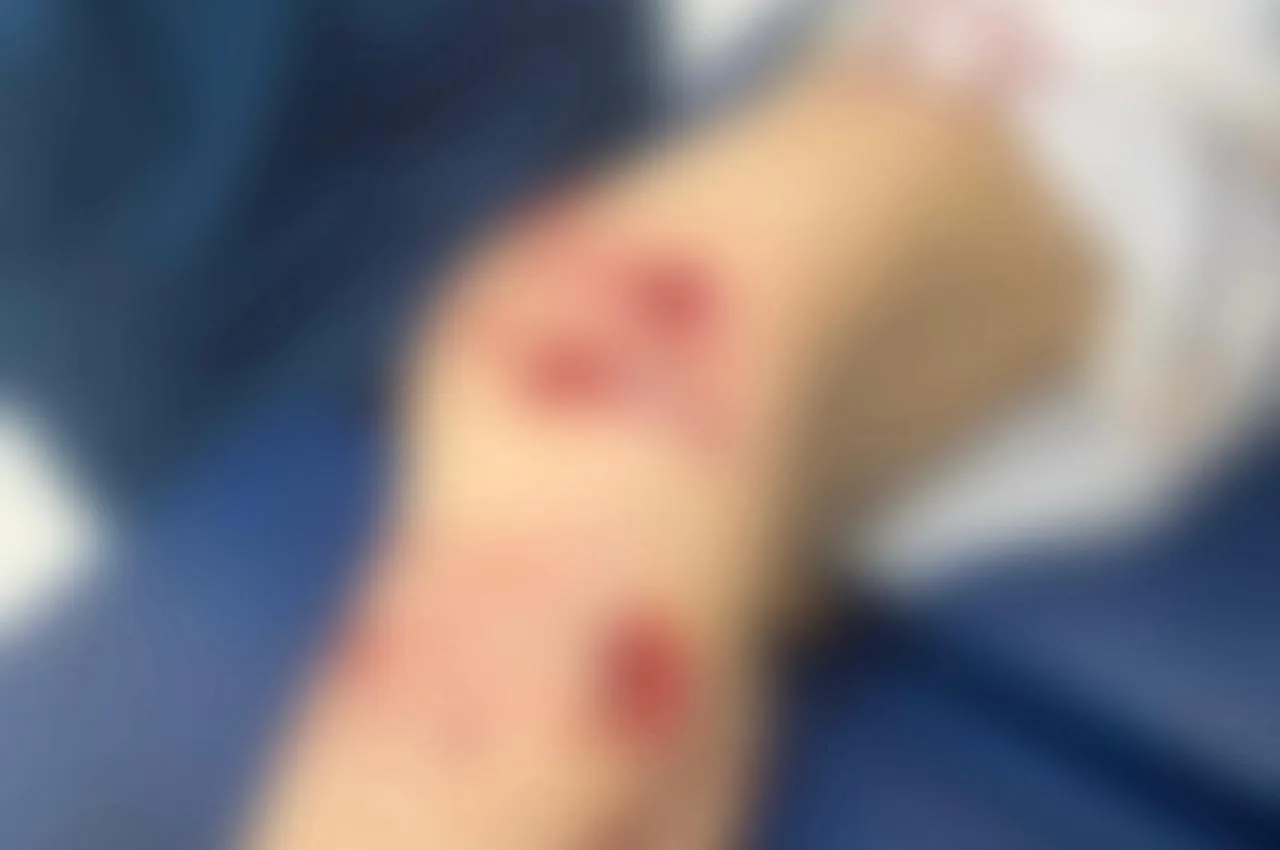 Стая собак напала на пятилетнего ребёнка в Уральске: угроза для безопасности детей Уральске