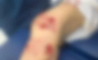 Стая собак напала на пятилетнего ребёнка в Уральске: угроза для безопасности детей
